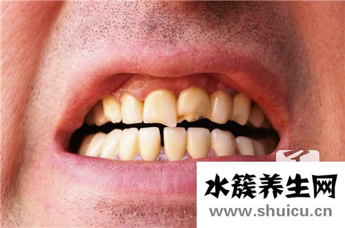 完全长出的智齿怎么拔？智齿没长出来怎么拔啊
