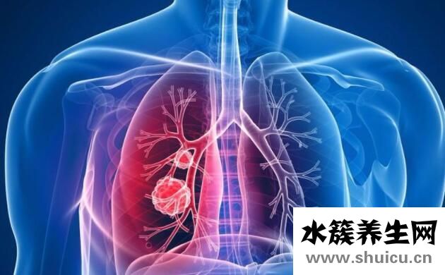 肺癌的15个征兆