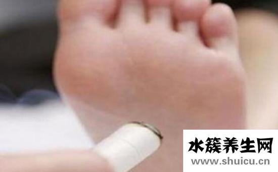 根治脚气的偏方