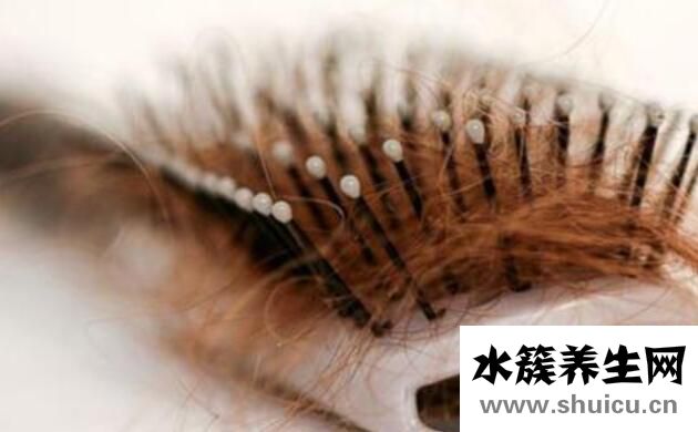 头发掉的厉害