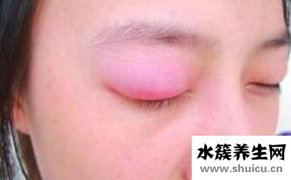 上眼皮肿是什么原因