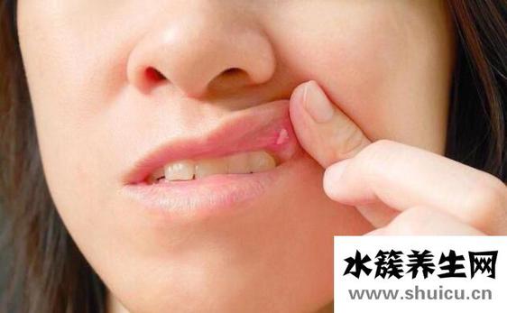 经常长口腔溃疡是什么原因？导致经常口腔溃疡的7个原因