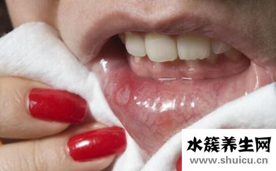 经常口腔溃疡是什么原因