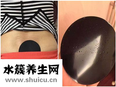 治疗闭经