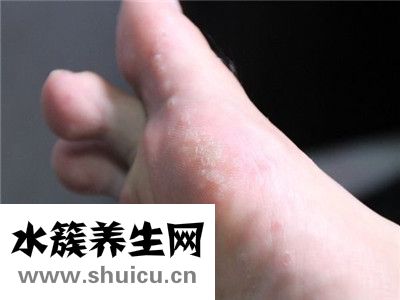 脚气产生的原因
