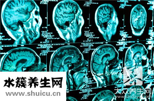 副肿瘤综合征