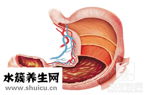 胃窦活检