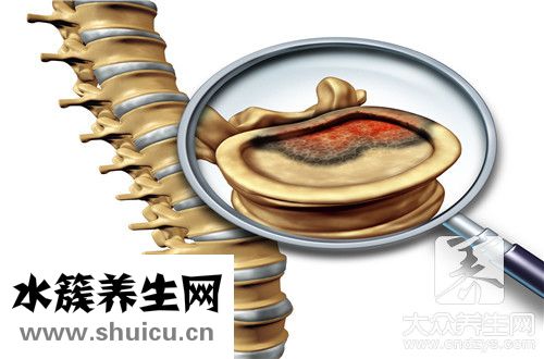 副肿瘤综合征
