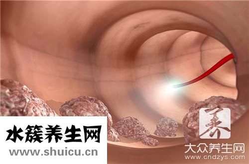 肛门脓肿办