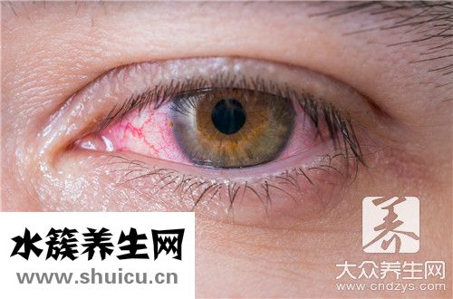 角膜瘢痕