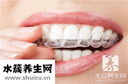 镶牙套