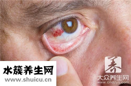 眼疾病有哪些