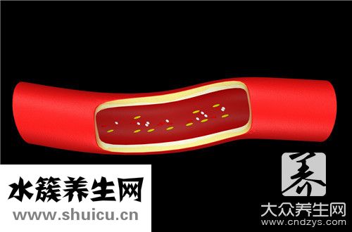 动脉血管堵塞
