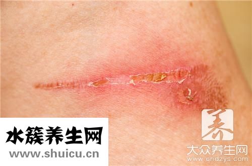 被兔子抓伤