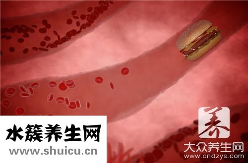 心血管钙化