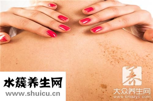 黄褐斑内调