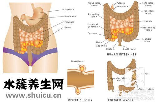 造口回纳手术成功率