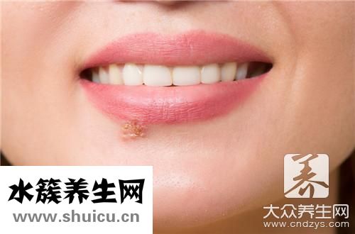 嘴唇起疱疹