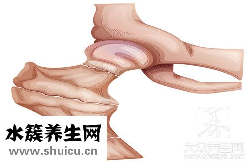 纠正骨盆