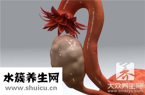 潴留囊肿