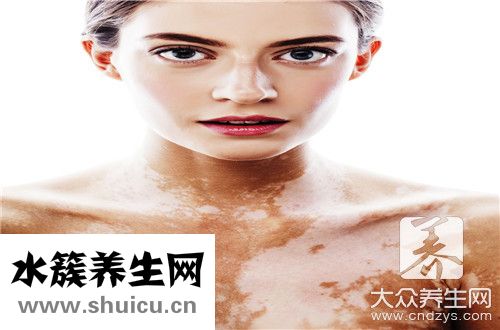 白斑症状
