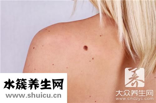 胎记危害