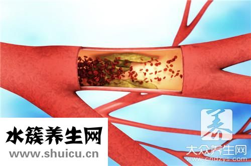 血管痉挛是回事