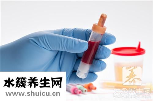 血清胰岛素