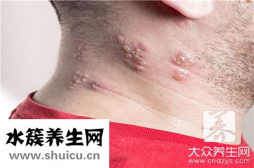 下巴肿