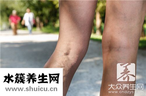 活动性出血
