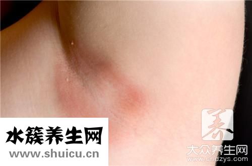脖子起红疹