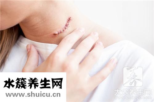 淋巴痛