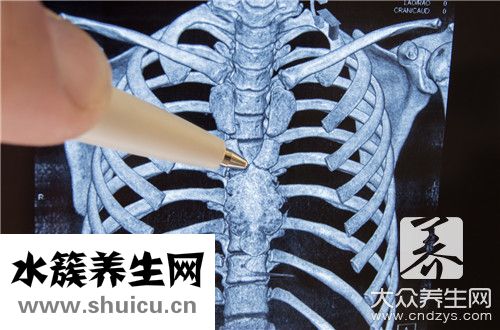 胶质瘤能治好吗
