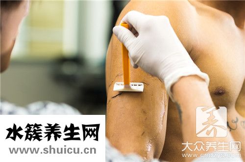 骨折固定