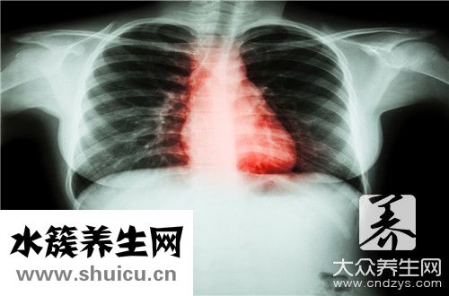 瓣膜性心脏病能活多久？心脏瓣膜病能活多久