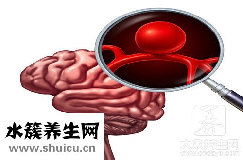 缺血灶