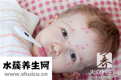 水痘潜伏期会传染吗