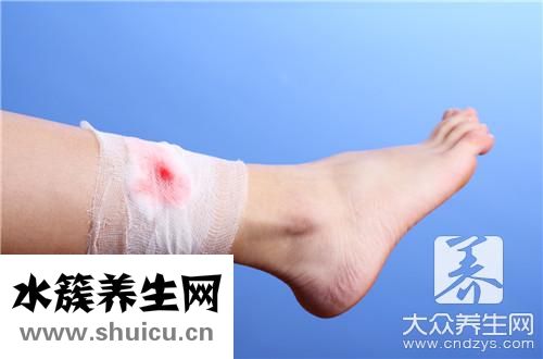 伤口缝针