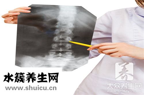 脊柱关节病