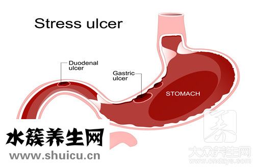 有胃炎舌苔黄厚怎么回事？经常舌苔黄厚是怎么回事