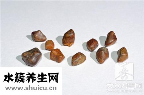 排出结石