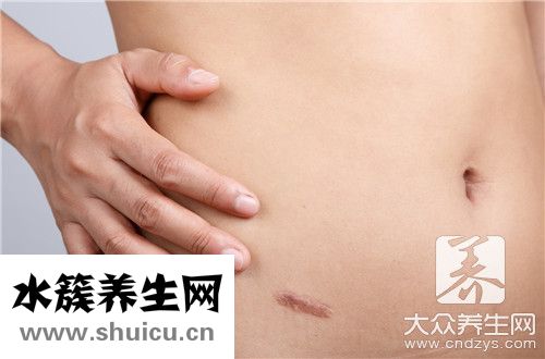 腹沟疝手术后几天能走
