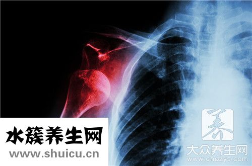关节镜手术恢复要一年