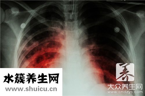 肺结核传染期