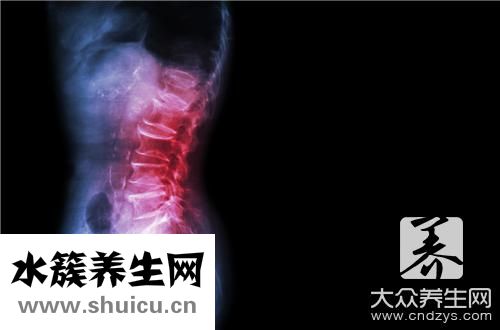 强直性脊柱炎一般寿命