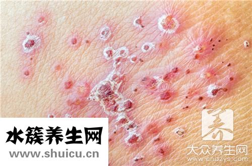 脱敏针一针多少钱
