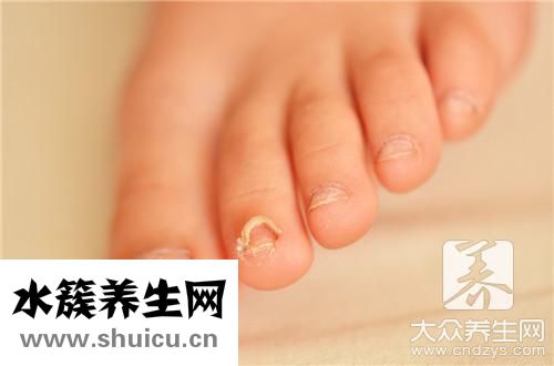 指甲都是密密麻麻小坑
