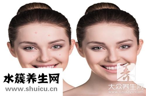 头皮毛囊堵塞
