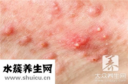 白色颗粒