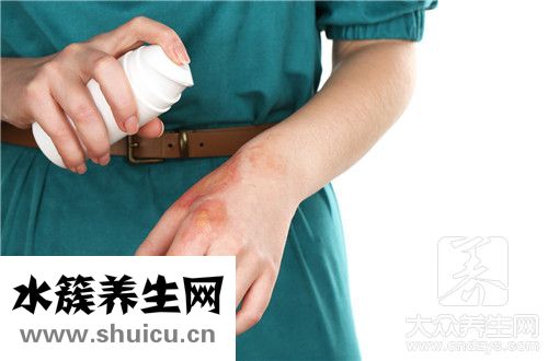 被油溅到了皮肤办